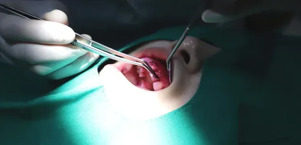 Brushing check