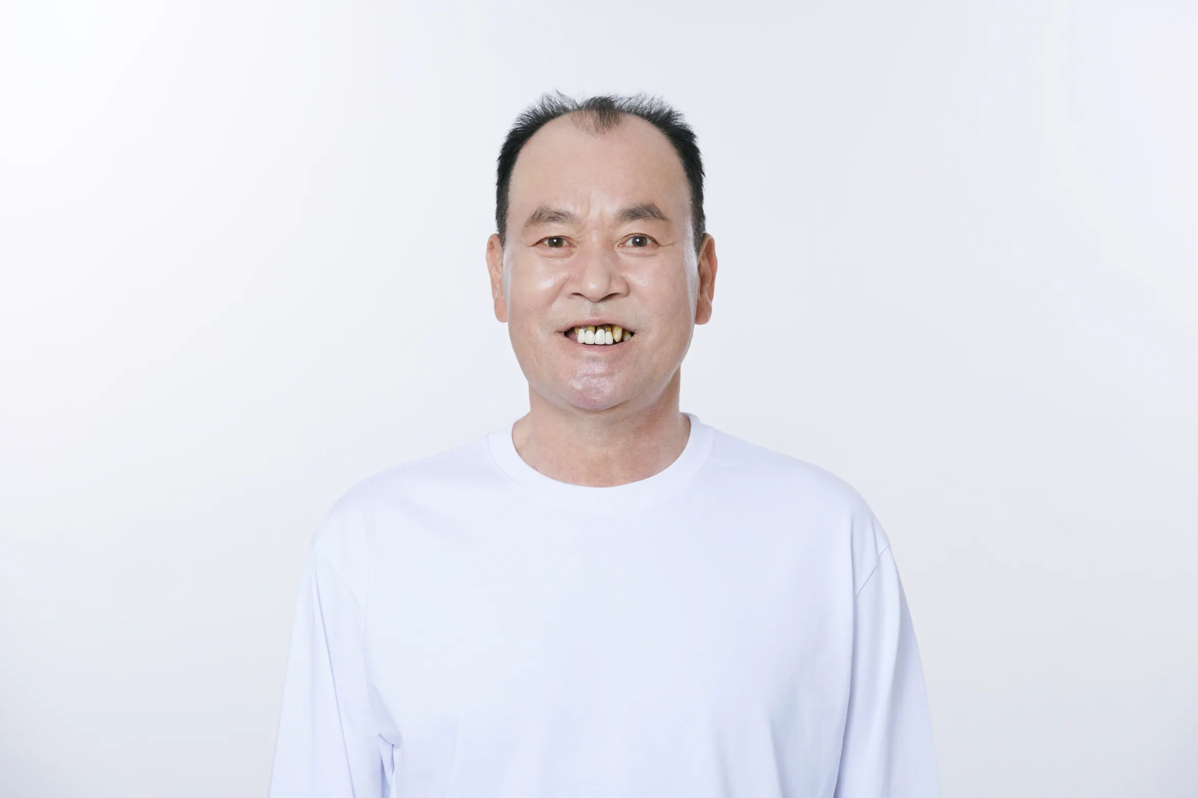Kim OO before treatment