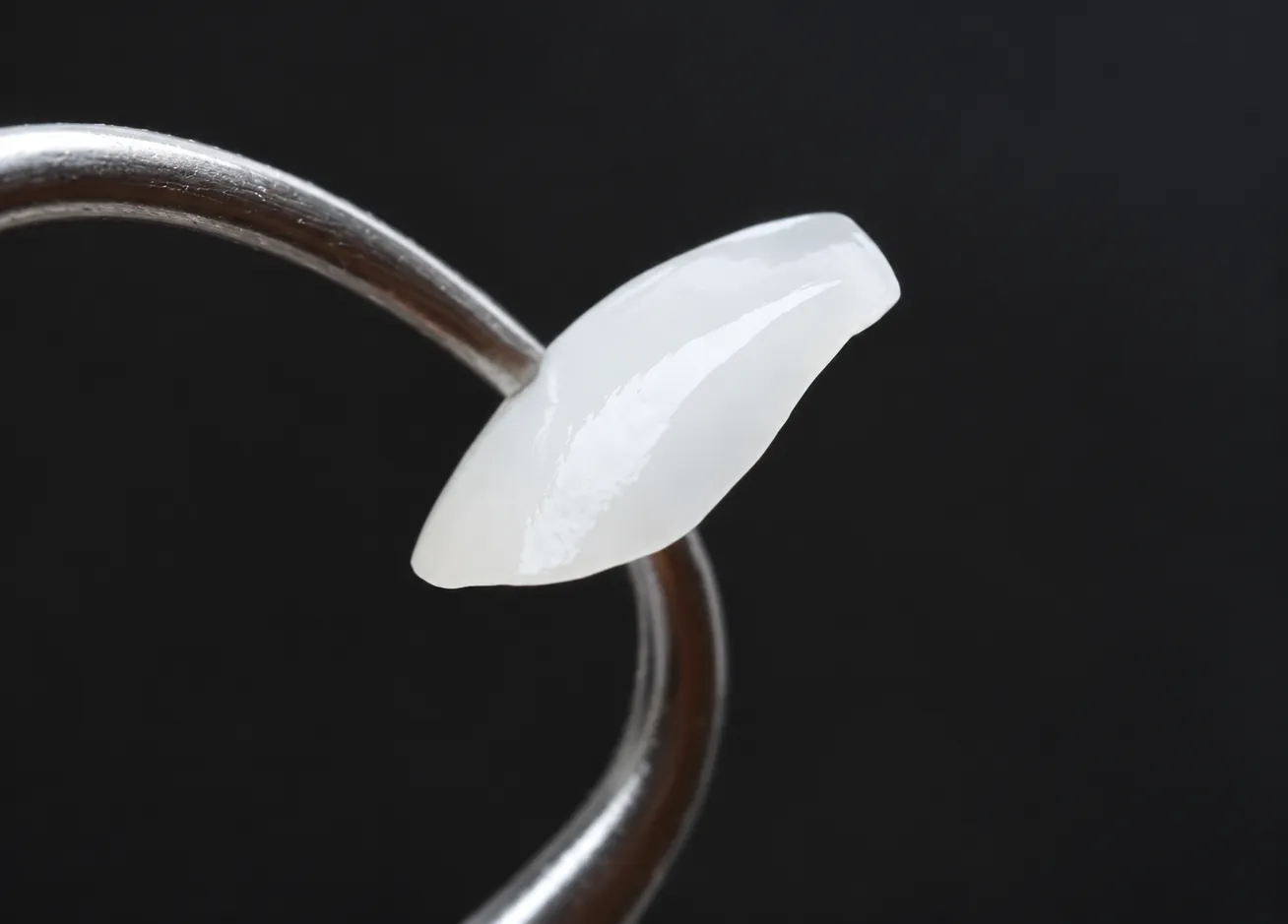 A thin ceramic laminate veneer on the tip of a dental instrument