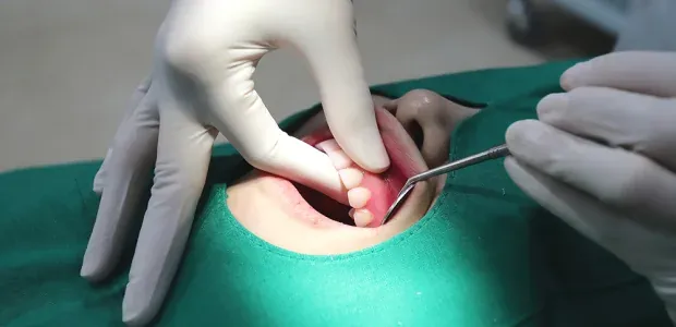 Gum massage