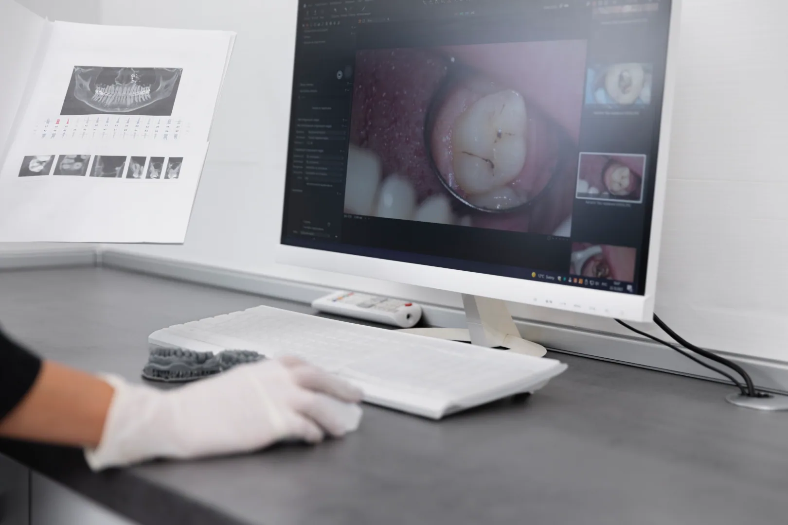 Checking the condition of the mouth on a diagnostic equipment screen