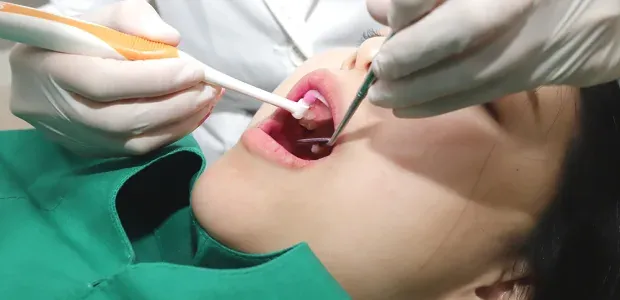 Implant site care