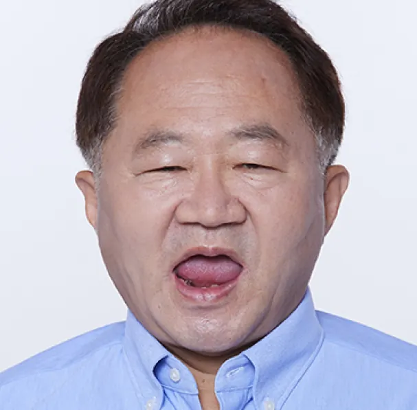 Choi** (60s), before treatment