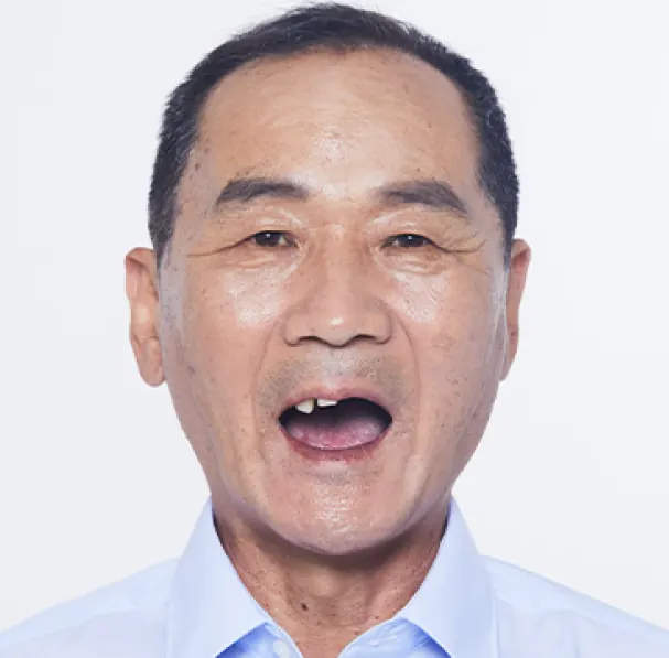 Jung** (60s), before treatment