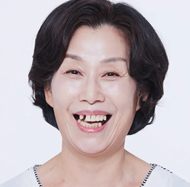 Jung** (60s), before treatment