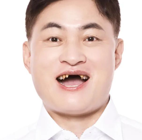 Lee** (40s), before treatment