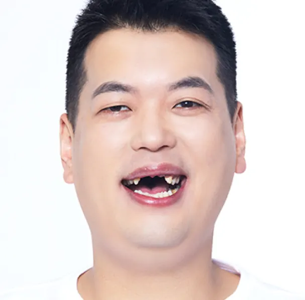 Park** (30s), before treatment