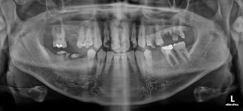 Park** (30s), pre-surgery panoramic X-ray