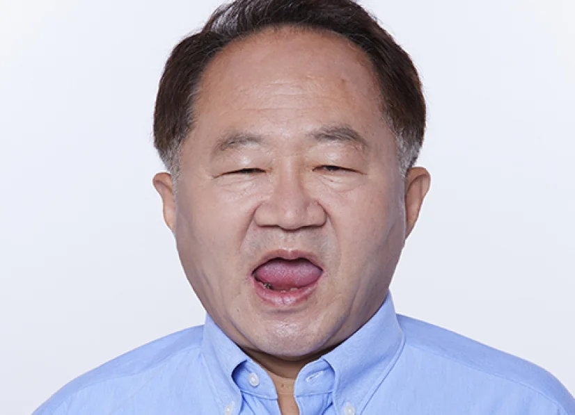 Choi OO before treatment