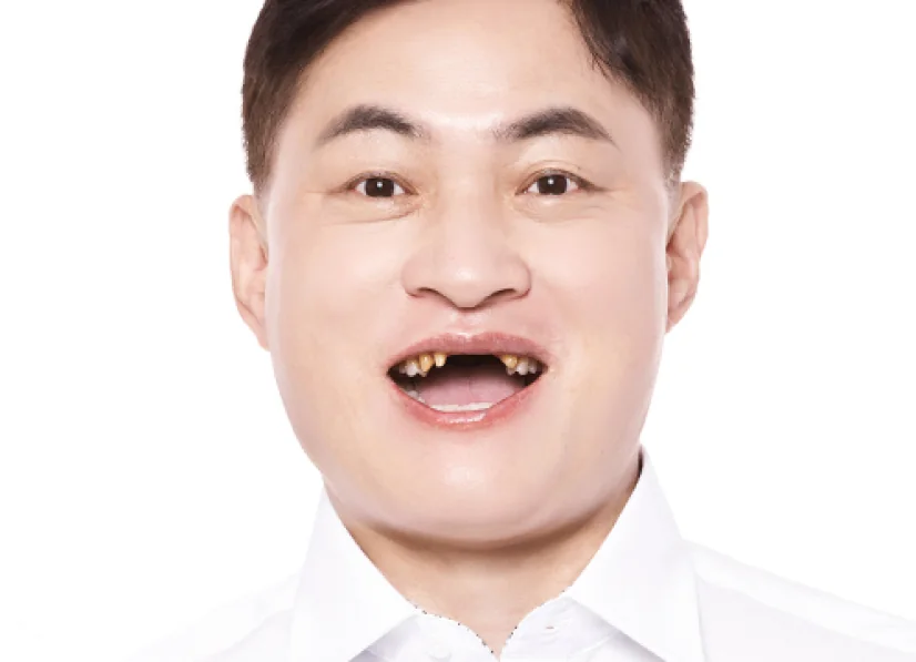 Lee OO before treatment